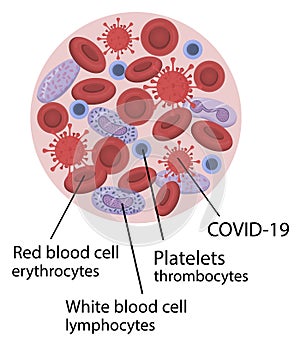 Blood infected with coronavirus