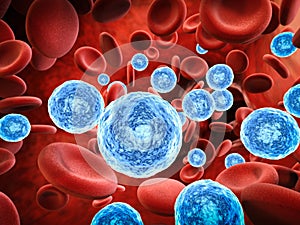 Blood infection with bacteria and virus cells
