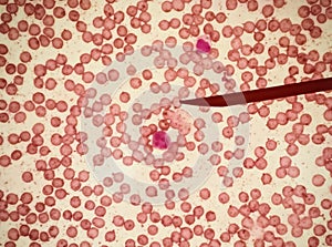 Blood leukocytes