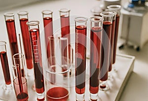 Blood plasma in test tubes for plasmalifting