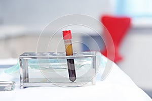 Blood plasma in test tubes for plasmalifting