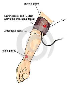 Blood pressure cuff on arm photo
