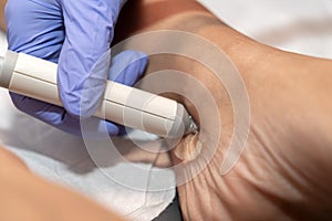 Blood pressure measurement from the popliteal artery leg, Ankle Brachial Index, Cardio?ankle vascular index, tibial pulse