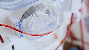 Blood Purification Medical Procedure - Plasmapheresis, Dialysis with Medical Device in Hospital