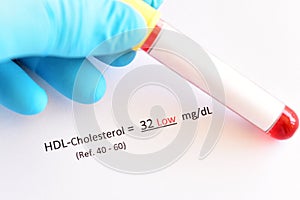 Abnormal high HDL-cholesterol test result