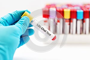 LDL cholesterol test