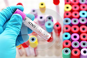 H7N9 influenza virus positive