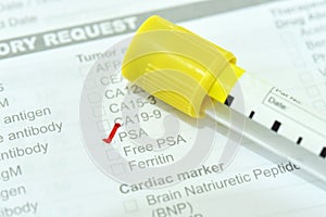 Blood sample tube for PSA test photo