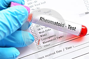 Blood sample tube for rheumatoid factor test