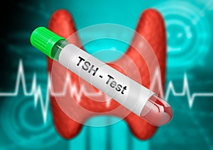 Blood sample tube for testing thyroid stimulating hormone. TSH test