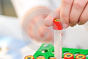 Blood sample tubes in hands