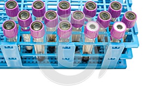 Blood sample tubes in rack on white background with copy space