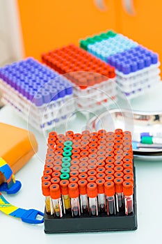 Blood samples test tubes in medical laboratory. Modern medicine testing analises.