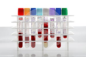 Medical test tubes with blood samples for medical analysis, Covid-19, Coronavirus Pandemic SARS, Flu, diseases , biochemistry