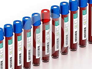 Blood samples in vials with HIV test labels isolated on white background. 3D illustration