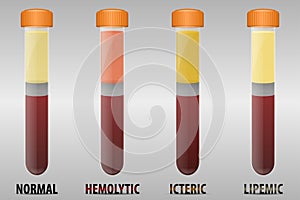 Blood serum common types