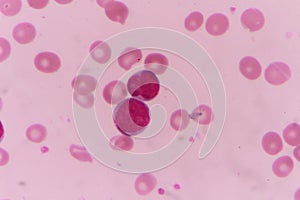 Blood smear