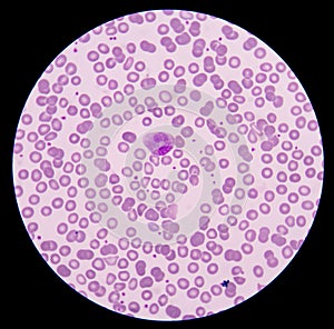 Blood smear.