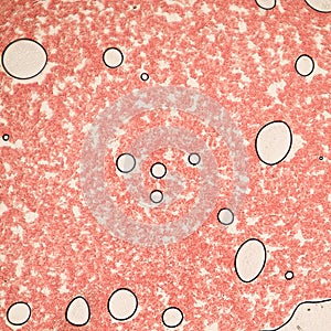 Blood smear under microscope present neutrophils and red blood cells. Photo micro sections with high magnification with