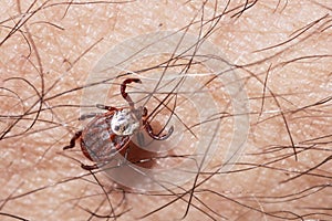 Blood-sucking mite on a human skin macro