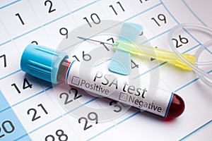 Blood test for analysis of PSA