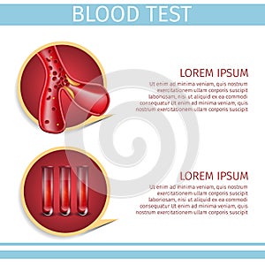 Blood Test Assay Square Hematology Medical Banner photo
