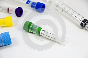 Blood test empty tubes samples on the white background, studio shoot