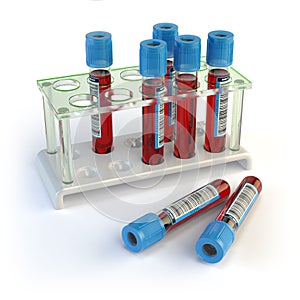 Blood test tubes. Blood samples in a rack on white.