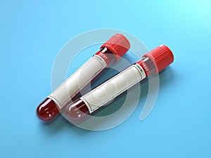 Blood test tubes  in the lab,Blood samples