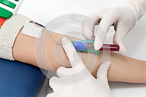 Blood test from vein