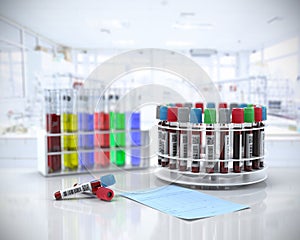 Blood tubes in the laboratory centrifuge photo