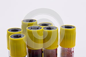 Blood tubes white background,isolated photo