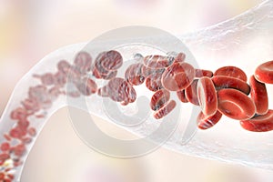 Blood vessel with erythrocytes and leukocytes photo