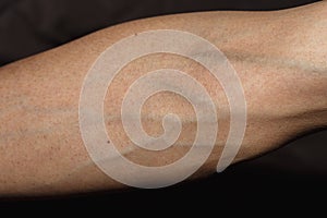 Blood vessel,Skinny arm,arm with blood veins on white background with clipping path.