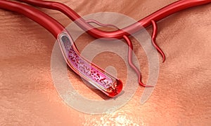 Blood vessel sliced macro with erythrocytes