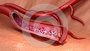 Blood vessel sliced macro with erythrocytes , Medically accurate illustration