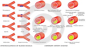 Blood vessels - arteries