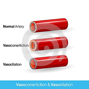 Blood vessels or capillaries or artery showing vasoconstriction and vasodilation blocking the blood flow cross section and side