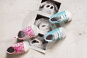 Blue and pink booties next to baby photos with ultrasound in 4th week of pregnancy. Twins. Son and daughter. Selective focus.