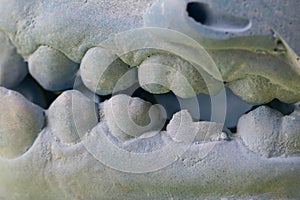 Blue plaster impression of the dental jaw of a patient with crooked teeth and malocclusions. Manufacturing of dentures