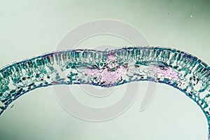 Blueberry leaf cross section under the microscope,