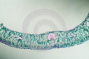 Blueberry leaf cross section under the microscope,