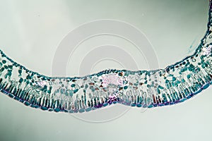 Blueberry leaf cross section under the microscope,