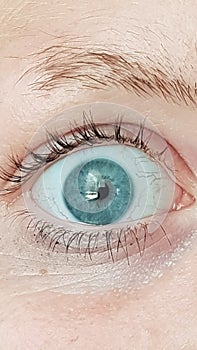 BlueEye