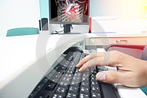 Blurred hand Doctor  on the keyboard taking the CTA result to the patient. Displayed on the LCD monitor