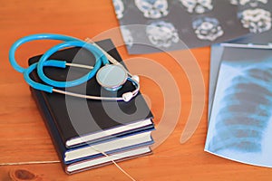 Blurred image,The doctor is diagnosing the tumor picture or cancer from the x-ray film of the patient`s brain in order to plan