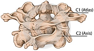 BOARD Atlas Axis Posterosuperior view