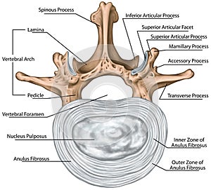 BOARD Structure of an intervertebral disk