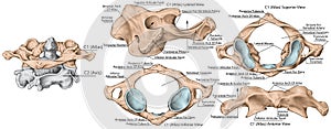 BOARD Vertebral morphology, first cervical vertebra