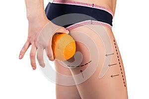 Body with cellulitis and orange fruit